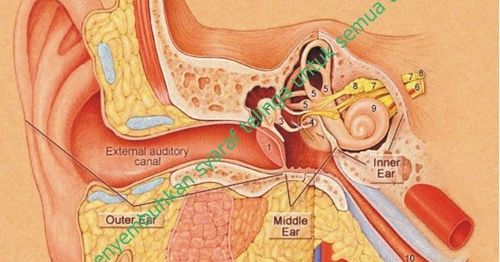 Cara Mengobati Pulsatile Tinnitus suara lembut dan menghindari mendengarkan